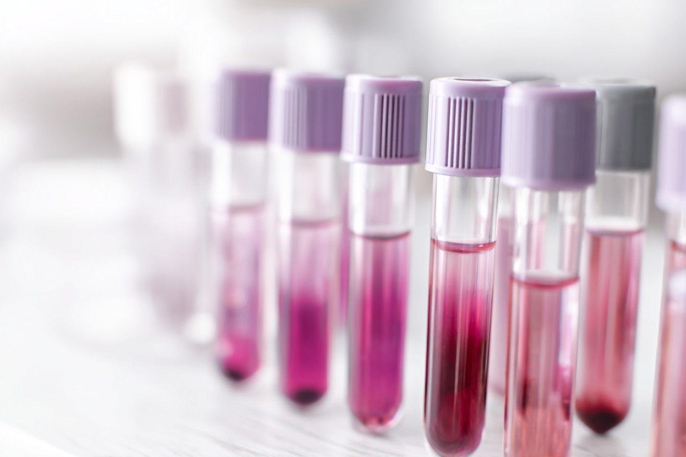 Autoimmune & Connective Tissue Disorders